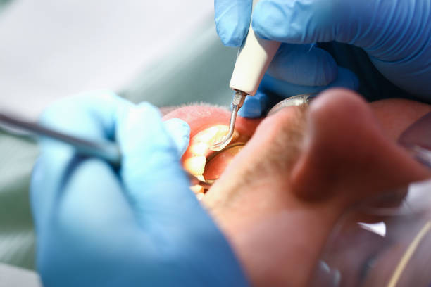 Best Emergency Treatment for Toothache in La Riviera, CA