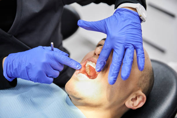 Best After-Hours Emergency Dentist in La Riviera, CA