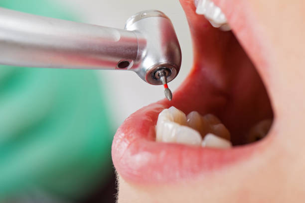 Best Emergency Treatment for Toothache in La Riviera, CA
